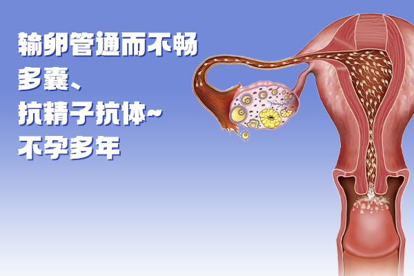 输卵管通而不畅、多囊、抗精子抗